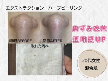 ミラ(Mira...)/☆Before→After☆
