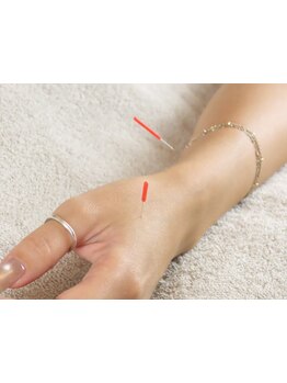 鍼灸施術を受けたい