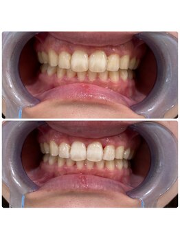 コナホワイトニング 神保町/セルフホワイトニング神保町