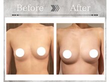 フェリス(Feliz)/【バストアップ/育乳/安城】