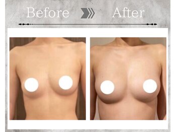 フェリス(Feliz)/【バストアップ/育乳/安城】