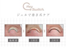 シェリーネイルサロン 姫路店(Cherie Nail salon)の雰囲気(夏に向けて巻き爪気になる方に♪巻き爪ケアコース!)