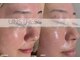 スイ(SUI)の写真