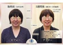 井原鍼灸整骨院/IAB美容鍼