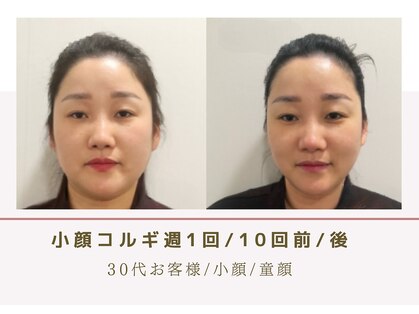 ルナビューティー 赤坂(LUNA beauty)の写真