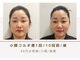 ルナビューティー 赤坂(LUNA beauty)の写真