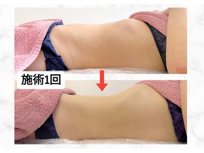 リルチェ 自由が丘(RILUCE)の写真