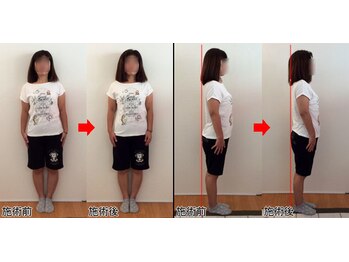 整体院プラス/全身スタイル矯正モニター