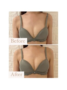 ハニー(Honey)/before★after