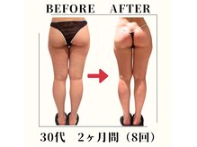 フェムビー(FemBe)の雰囲気（【１回でも効果実感】結果が目で見て分かるから楽しく続けられる）
