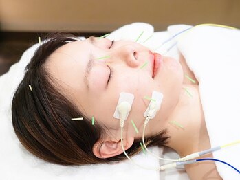 アキュレ(Acure)の写真/加齢とともにたるみが気になる方に♪美容鍼×EMSの新世代施術で若々しい印象のお顔へ◎