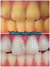 ホワイトニングショップ 山形店(Whiteningshop)/均等に白くなる