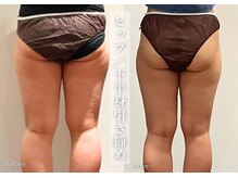 シューラディアント(ShuRadiant)/お悩み別に部分ケア