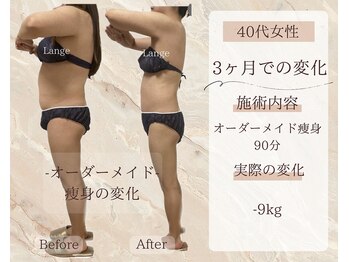 サロン ド ボーテ ラーンジュ 岐阜店(salon de beaut'e L'ange)/ハイパ-ナイフEX2ダイエット痩身