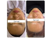 ルピナージュ(Lupinage)の雰囲気（【産毛×角質×肌育成】うる艶ワックス×幹細胞フェイシャル）