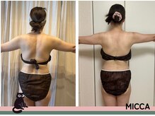 ヨサパーク ミッカ 学芸大学(YOSA PARK MiCCA.)/【水素まみれコース】11回１ヶ月