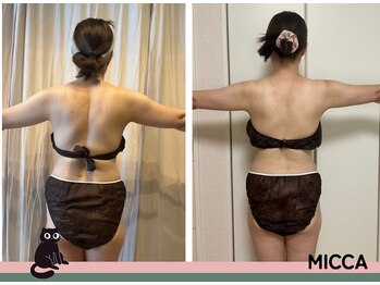 ヨサパーク ミッカ 学芸大学(YOSA PARK MiCCA.)/【水素まみれコース】11回1ヶ月