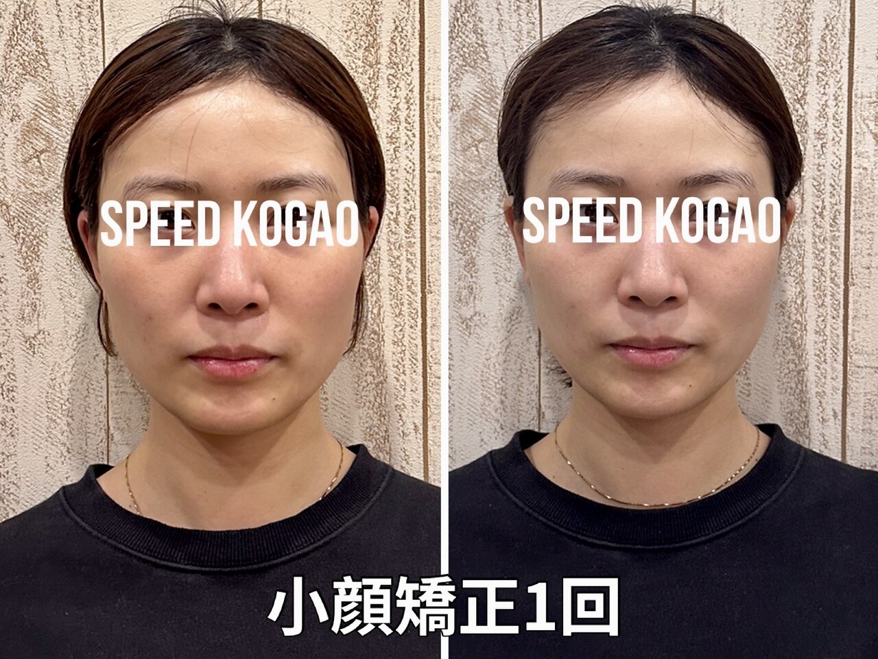 スピード小顔 渋谷店 (Speed)｜ホットペッパービューティー