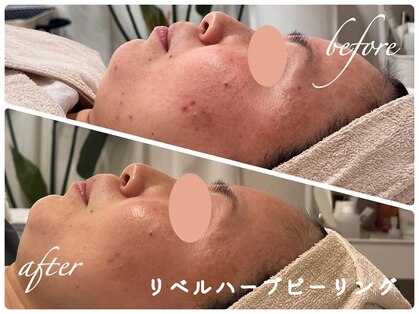 チップ(chip)の写真