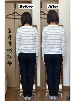 ナチュラルライフ(Natural Life)/全身骨格調整