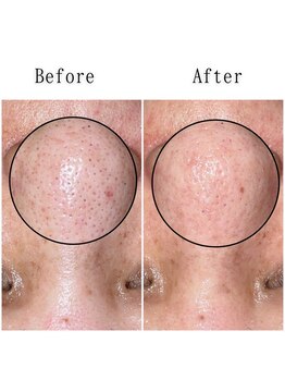 グラシア(gracia)/シミ・毛穴ケア専門店gracia