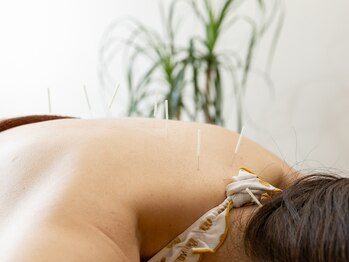 はな鍼灸院/背中のはり