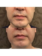 フェリーバ(FELIVA)/綺麗になりました♪