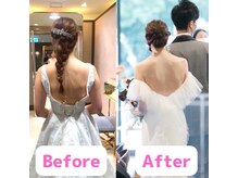 オハナ整骨院(Ohana整骨院)/肩周りスッキリで首長効果！