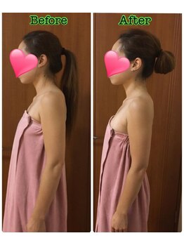 トータルボディセラピーハート(Heart)/猫背矯正・巻き肩・スマホ首改善