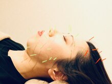 クマノミ美容鍼灸 川口院(KUMANOMI美容鍼灸)/眼精疲労や自律神経の整えにも◎