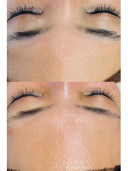 ルーク(Luke)/毛穴ケア