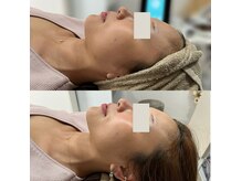 ダリア(Dahlia)の雰囲気(人気施術【30代・40代編】高周波たるみケア♪オニキス★)