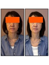 ピュアグレース 自由が丘/50代からのお肌改善☆