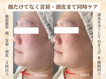 ミスティア(mistia)の雰囲気（頭皮から整えフェイスラインと軽さ実感◎印象変わるメンテケア♪）