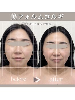 ジョワ(JOIE)の写真/【人気No.1】徹底改善向け｜美フォルムコルギ×選べるオプション90分 〈ご新規様9900円〉