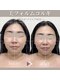 ジョワ(JOIE)の写真/【人気No.1】徹底改善向け｜美フォルムコルギ×選べるオプション90分 〈ご新規様9900円〉