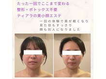 ティアラ(Tiara)の雰囲気(人気No.1 骨格から整える美小顔矯正)