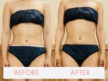 サロンソワ(salon Soi.)の雰囲気（第二の脳といわれる腸に、優しく暖かく触れる腸もみでスッキリ！）