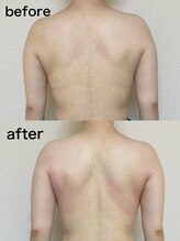 小顔堂 大阪心斎橋店/痩身コルギ深部リンパマッサージ