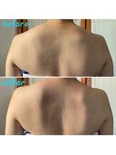 ルアナ 北谷店/リンパマッサージ 《沖縄/北谷》