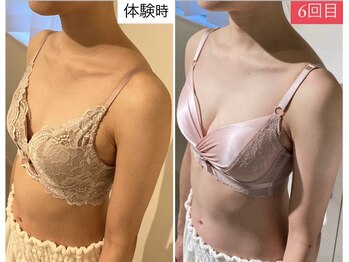 ラビス(RAVIS)/本格ケアでC→Eカップへ劇的変化