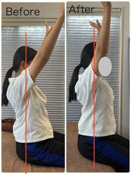 リアン(Liam)/姿勢改善/肩の痛み改善