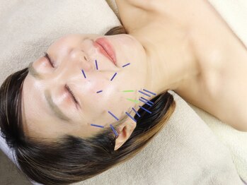 ハリーベージュ(Hariy Beige)の写真/【麻布十番駅から徒歩1分！】女性鍼灸師による美容鍼で肌質改善/小顔ケア◎鍼初心者の方も大歓迎