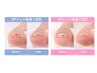 UPGEL【巻き爪ケア＆ワンカラー】ジェルネイルしながら巻き爪ケア