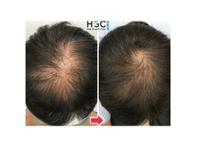 HGCラボ 新宿店