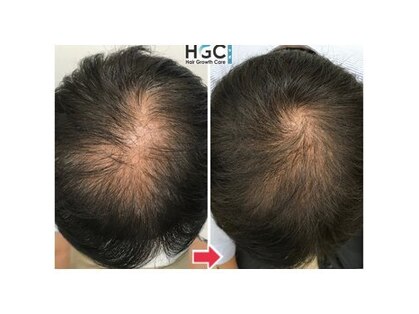 HGCラボ 新宿店の写真