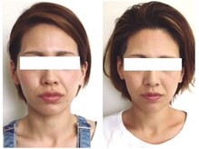 美容整体ウェリナ 名駅院/小顔矯正/骨盤矯正/美脚サロン