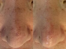 サイセイ(SAISEI)/