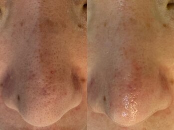 サイセイ(SAISEI)/