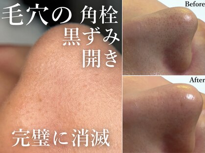 キャンディ 大阪梅田店(CANDi)の写真